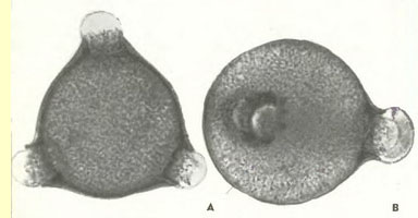 Иван-чай (Chamaenerium angustifolium Adans.) - пыльцевые зерна Иван-чай (Chamaenerium angustifolium Adans.) - пыльцевые зерна